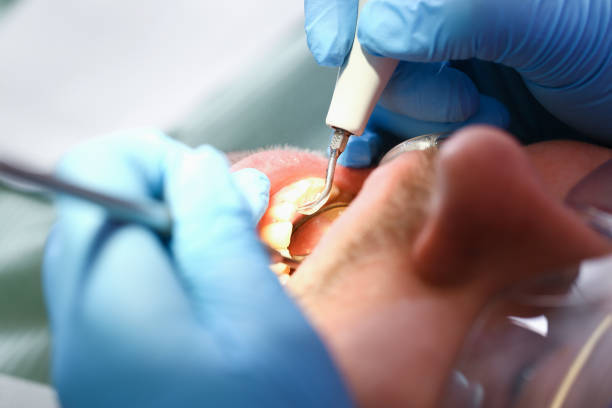 Best Emergency Denture Repair in Morrison, IL